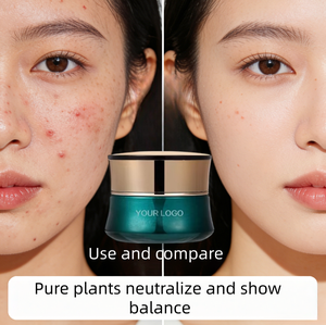 Natural Plant Balancing Cream Vegan Herbal Balancing Cream with <strong>Aloe</strong> <strong>Vera</strong> Oily Skin Acne Treatment OEM Customization - Product Image 3