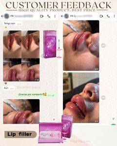 Relleno <span class=keywords><strong>de</strong></span> <span class=keywords><strong>Labios</strong></span> para Pedidos al por Mayor, 10ml, Relleno Dérmico Inyectable, Gel <span class=keywords><strong>de</strong></span> Ácido Hialurónico para <span class=keywords><strong>Aumento</strong></span> <span class=keywords><strong>de</strong></span> <span class=keywords><strong>Labios</strong></span>, Compatible <span class=keywords><strong>con</strong></span> OEM/ODM - Product Image 6