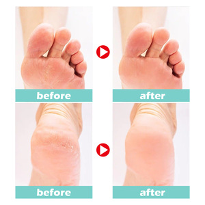 Crème pour les pieds pour les talons secs et gercés, hydratante et nourrissante - Product Image 3