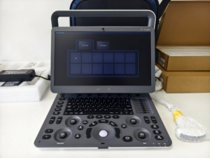 Sonoscape E1expv, Mejor Precio, Ecógrafo Doppler Color Portátil de Alta Calidad, Máquina de Ultrasonido Doppler Color para Veterinaria - Product Image 6