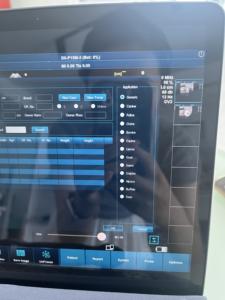 Mesin <span class=keywords><strong>Ultrasound</strong></span> Convex/Linear/Heart kualitas tinggi nirkabel 3 in 1 JM-5 <span class=keywords><strong>Ultrasound</strong></span> <span class=keywords><strong>Probe</strong></span> - Product Image 6