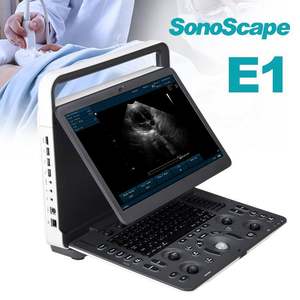 High-End Diagnostisch Systeem Sonoscape Doppler Ultrasone Machine Sonoscape E1 - Product Image 1