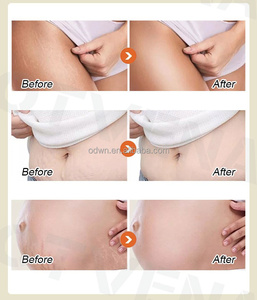 Nhãn Hiệu Riêng Chất Béo Đốt Cháy Tummy Mạnh Mẽ Bụng Cơ Bắp Bắp Bụng Kem Giảm Béo Gel - Product Image 2