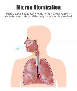 <span class=keywords><strong>Nébuliseur</strong></span> ultrasonique portable léger à mailles électriques, facile à transporter, en promotion - Product Image 2