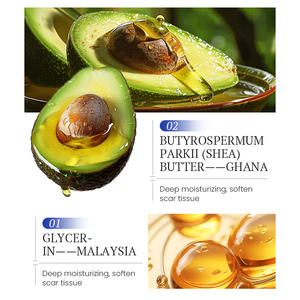Crème cicatrisante KORMESIC, marque privée, OEM personnalisé, réparation des cicatrices, nourrit en profondeur la peau, favorise la régénération cutanée, crème anti-cicatrices - Product Image 4