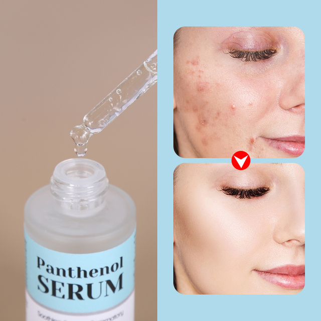 Professional 30ml Repair Panthenol Nourishing Face Serum with Hydrolyzed Sodium Hyaluronate Moisturizing Formula