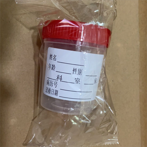100ml <span class=keywords><strong>120ml</strong></span> mẫu <span class=keywords><strong>container</strong></span> nơi để tiểu cup dùng một lần vô trùng mẫu ly Có/không có nhãn nước tiểu <span class=keywords><strong>container</strong></span> - Product Image 4