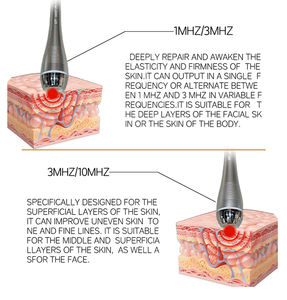 Dispositivo Portátil ABS de Ultrasonido Antienvejecimiento de 3MHz y 10MHz para Reducir Poros y Lifting Facial, para Uso en Salón de Belleza y en Casa - Product Image 2