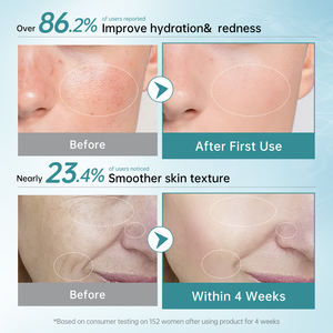 PDRN Hyaluronik Asit Tek Günlük Kapsül Serum Ampulü Niacinamide ile Cilt Parlaklığını Artırır Nemlendirir ve Işıltılı Bir Cilt Sağlar - Product Image 5