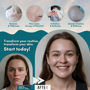 Baume au suif de bœuf nourri à l'herbe, marque privée, avec du miel, beurre corporel fouetté au suif pour le visage et le corps - Product Image 2