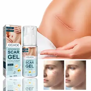 Herbal Scar Removal Cream Acne Spots Burn Surgical Scars Treatment Smooth Whitening Face Body Skin Care Stretch Marks Remove Gel