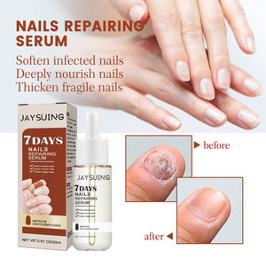 Suero Reparador de Uñas Herbal Efectivo JAYSUING, <span class=keywords><strong>Tratamiento</strong></span> para <span class=keywords><strong>Hongos</strong></span> <span class=keywords><strong>en</strong></span> las Uñas <span class=keywords><strong>en</strong></span> 7 Días - Product Image 4