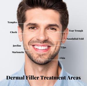 Solution de Remplissage Dermal à l'Acide Hyaluronique 2ml pour un Soutien Volumineux et un Remodelage Facial - Product Image 2