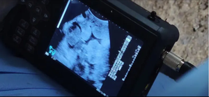 Mesin <span class=keywords><strong>Ultrasound</strong></span> spon <span class=keywords><strong>Ultrasound</strong></span> nirkabel untuk dokter hewan Bovine Equine portabel dokter hewan sonosape <span class=keywords><strong>Ultrasound</strong></span> - Product Image 6