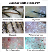 Analyseur de cheveux et de cuir chevelu 2 en 1 de bonne qualité et analyseur de peau du visage