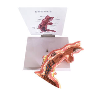 Modelo Anatómico de Enfermedad Patológica del Esófago KyrenMed, Modelo de Polipo Esofágico con <span class=keywords><strong>Erosión</strong></span>, Ampliado 5 Veces - Product Image 3