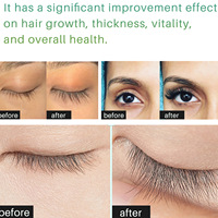 Marque privée 100% huile de ricin biologique huile de ricin pressée à froid en gros pour la croissance des cheveux perte soins capillaires essentiels huile de ricin