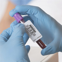 Acrylic Adhesive Medical Label -196 Degree Nitrogen Laboratory Cryo Label Low Temperature Resistant Rolls for Packing Sealing