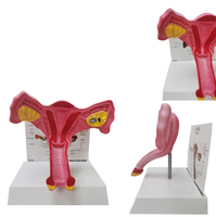 Modèles anatomiques grandeur nature de l'organisme vaginal et ovarien féminin et modèles anatomiques pathologiques de l'utérus pour l'enseignement médical CE/ISO