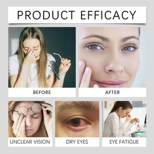 Cápsulas para la Vista de Primera Calidad al por Mayor OEM, Suplemento para Aliviar la Fatiga Ocular y Mejorar la Visión, 60 Cápsulas para Adultos - Product Image 5