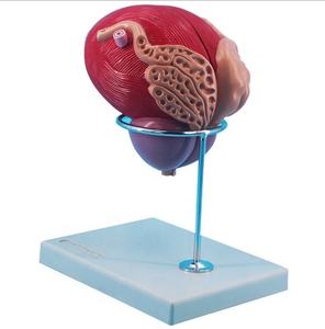 Modelo <span class=keywords><strong>de</strong></span> Agrandamiento <span class=keywords><strong>de</strong></span> <span class=keywords><strong>la</strong></span> <span class=keywords><strong>Vejiga</strong></span> Masculina del Sistema Genitourinario, Modelo Estructural con Orificios Uretrales y Glándula Prostática - Product Image 2