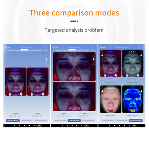 CHINA <span class=keywords><strong>Best</strong></span> Selling <span class=keywords><strong>3D</strong></span> Face <span class=keywords><strong>Scanner</strong></span> Analizador de piel facial Análisis Máquina de piel - Product Image 6
