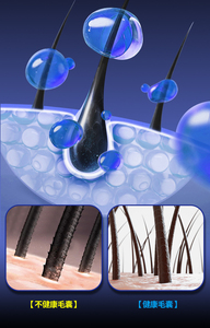 <b>Electric</b> Scalp <b>Massage</b> Comb With Dual Light Therapy High Frequency Vibration For Hair Care Home Salon Use Rechargeable Portable - Product Image 4