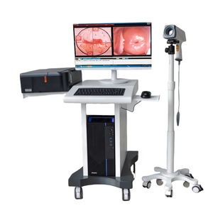 स्त्रीरोग के लिए पोर्टेबल डिजिटल इलेक्ट्रॉनिक वीडियो कोपोस्कोप योनि परीक्षा के लिए - Product Image 4