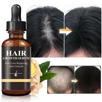 Фирменная натуральная питательная сыворотка против выпадения волос для мужчин и женщин, средство для лечения облысения волос, масло для роста волос