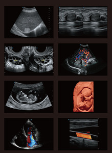 Sonoscape P20 Maquinas De Ultrasonido Medico <span class=keywords><strong>3d</strong></span> <span class=keywords><strong>4d</strong></span> 5d Ultrasone Kleur <span class=keywords><strong>Doppler</strong></span> - Product Image 5
