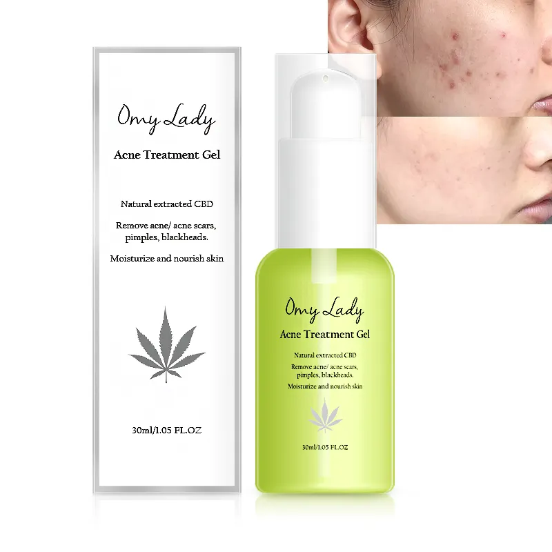 Gratis Private Label Groene Thee Litteken Verwijderen Puistjes Behandeling Vochtige Anti Acne Crème