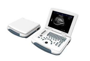 Sonde à ultrasons portable, instrument de diagnostic à ultrasons couleur Doppler sans fil à double tête pour hôpital - Product Image 2