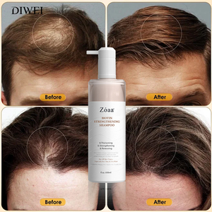 DIWEI Marque Blanche Bio Shampooing et Revitalisant à la <span class=keywords><strong>Biotine</strong></span> Naturelle sans Sulfate pour Hommes et Femmes - Product Image 5