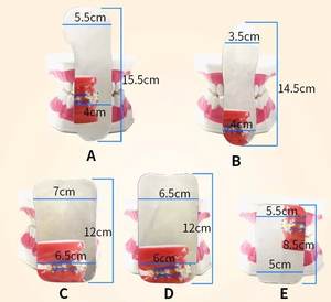 กระจกทันตกรรม5ชิ้น/เซ็ต, กระจกสะท้อนแสงสำหรับจัดฟันในปากกระจกส่องเครื่องมือทันตกรรมกระจกสองด้าน - Product Image 5