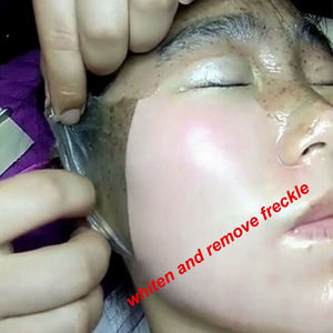 Herbal T Zone Nez Blackhead Remove <span class=keywords><strong>Masque</strong></span> De Visage Anti Tache Dark Spot Remover <span class=keywords><strong>Peel</strong></span> <span class=keywords><strong>off</strong></span> <span class=keywords><strong>Masque</strong></span> facial blanchissant pour les Salons de beauté - Product Image 2