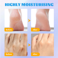 Stick de Soin des Pieds à l'Urée pour Talons Secs et Fissurés, Éliminateur de Callosités, Traitement Hydratant pour les Pieds – Exfolie et Adoucit les Peaux Rudes – En Stock