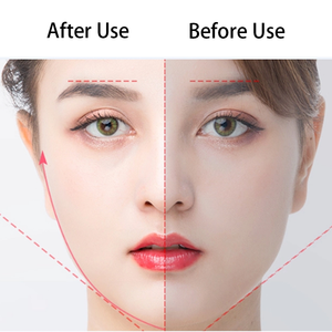 Productos de belleza Masajeador de ojos portátil para eliminación de Círculos oscuros de arrugas y vibración ocular - Product Image 5