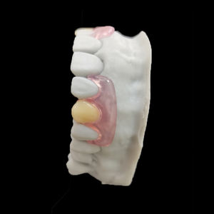 Vente en gros de prothèses dentaires Valplast amovibles flexibles en acrylique, externalisation de laboratoire dentaire en Chine, prix bon marché pour Agnet dentaire - Product Image 3