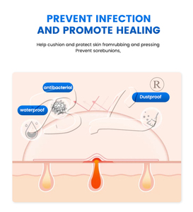 <span class=keywords><strong>Patch</strong></span> untuk menghilangkan jerawat, tempelan jerawat hidrokoloid tahan debu 36 buah kustom harga pabrik - Product Image 5