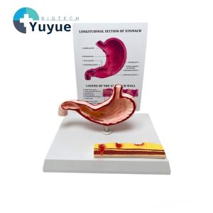 แบบจำลองกายวิภาคกระเพาะอาหารมนุษย์พร้อมโรคภูมิภาคนิยมพบกัน ตัดตามยาว สำหรับ<span class=keywords><strong>การ</strong></span>สอนทาง<span class=keywords><strong>การ</strong></span>แพทย์ - Product Image 1