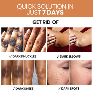 Özel etiket cilt bakımı aydınlatıcı koyu Knuckle dizler beyazlatma siyah cilt beyazlatma kremi tam Set siyah kadınlar için koyu cilt - Product Image 4