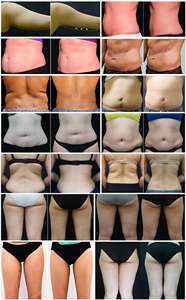 Bodytite M8 6/8 pegangan 4 En 1 Lipolaser lampu merah terapi pembakar lemak Ems tesla vakum frekuensi Radio mesin pembentuk otot - Product Image 6