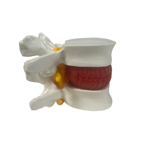 Model kerangka sains medis, untuk demonstrasi herniasi Lumbar bahan PVC untuk pelatihan perawat di sekolah - Product Image 3