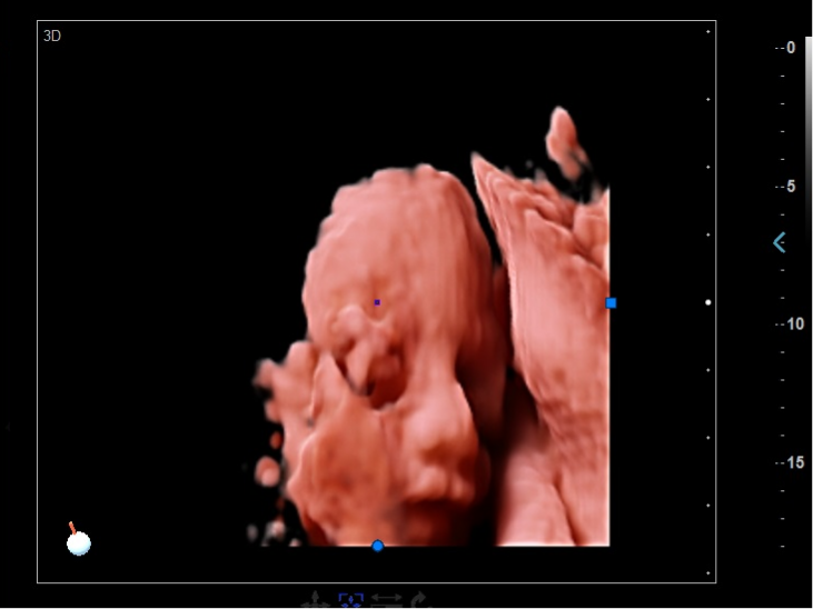 GH-F5pro3D Home Fetal Ultrasound Machine Echographe Equipment For Obsteristic Gynecology