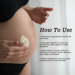 Nhãn Hiệu Riêng Căng Đánh Dấu Loại Bỏ Kem Mang Thai Phai Dòng Lột Bụng Bơ Cho Mang Thai Căng Đánh Dấu - Product Image 4