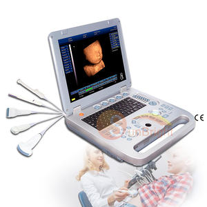 Ecografía Vascular, Cardíaca y Fetal, Ultrasonido 3D 4D, Rentable - Product Image 1