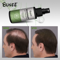 Minyak serum penumbuh rambut Vegan organik penumbuh rambut Rosemary Biotin untuk kulit kepala pisah dan kering.