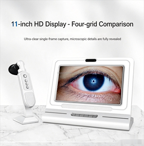 Professional AI Digital Eye and Skin Analyzer Smart Iriscope Camera for Beauty Salon and Aesthetic Clinic - Product Image 2