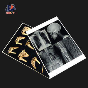 China Kenid Agfa Fuji Digunakan Dalam Pembuatan Film Thermal Medis Kering Printer Medis X-Ray Film - Product Image 5