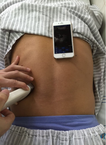 Mini cầm tay siêu Thiết bị wifi Android IOS kết nối để sử dụng nhà mang thai giám sát sức khỏe cơ bản kiểm tra máy quét - Product Image 6